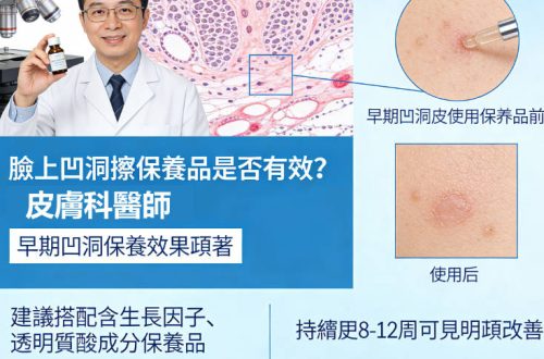 凹洞保養品是否有效