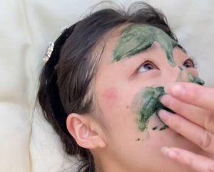 藻針換膚